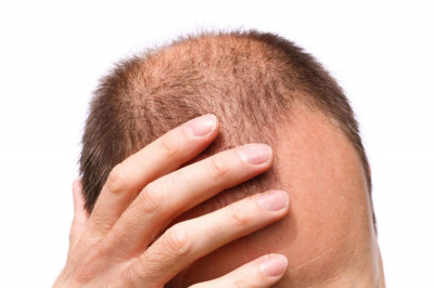 تعرَف بنفسك على اكتشاف يحمي شعرك من التساقط