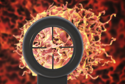 البلاستيك يهدد الرجال بالإصابة بسرطان البروستات